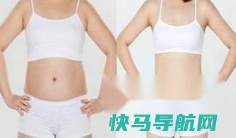吸脂去脂肪会反弹吗 第3张